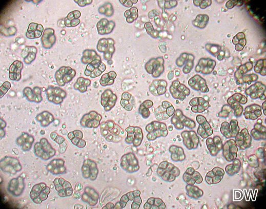 Cheiromycella microscopica Cheiromycella microscopica