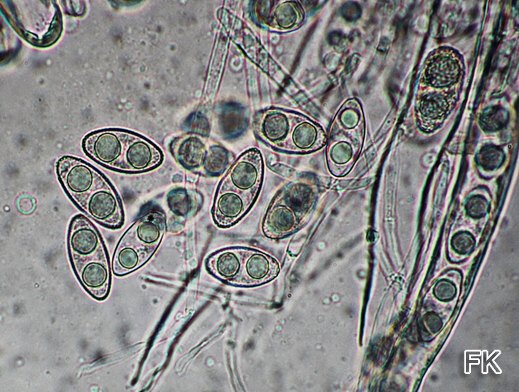 Leucoscypha leucotricha - Weißhaarbecherling