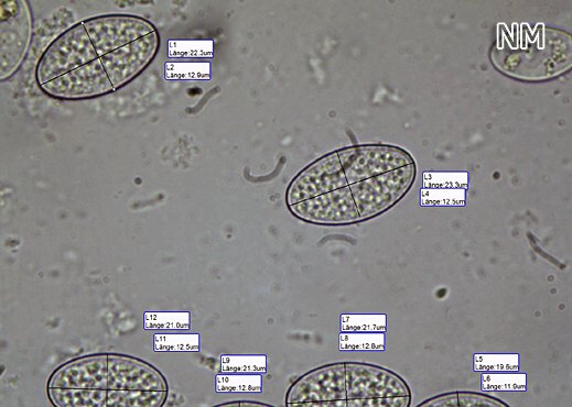 Miladina lecithina - Orangefarbener Wasser-Kissenbecherling, Sporen