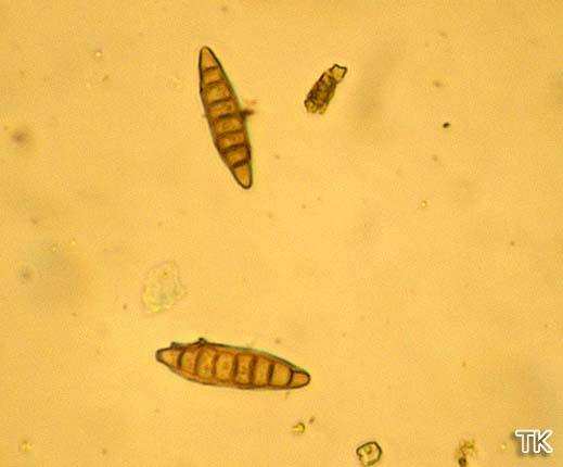 Sporen von Pseudospiropes simplex