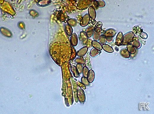 Pleurocystide von Agrocybe arvalis