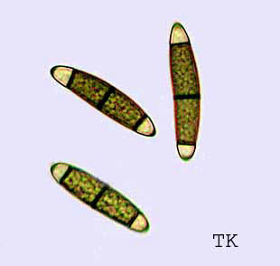 Chaetosphaerella phaeostroma