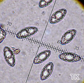 Sporen Geopora sumneriana