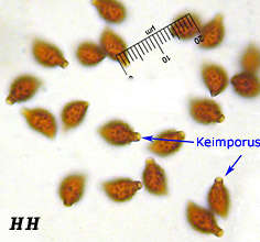 Sporen Lacrymaria lacrymabunda