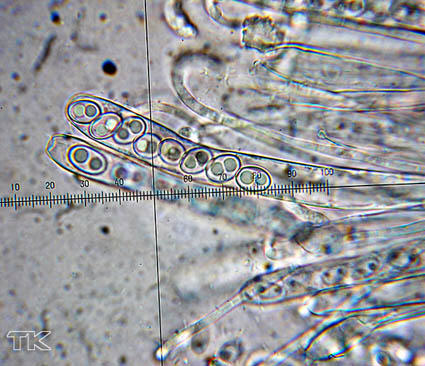 Asci und Paraphysen