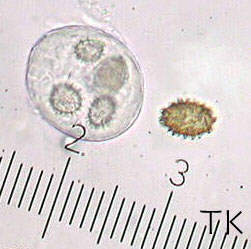 Sporen Tuber indicum