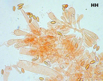 Sporen Xerocomus subtomentosus